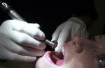 ændring. Tandlægerne har længe troet, at caries var en sygdom, hvor kurven ville fortsætte med at falde støt i de kommende generationer. 