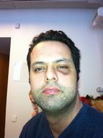 Stop. Ifølge Amin Skov selv blev han overfaldet 21. december på Restaurant Vejlegården, og sådan her så han ud ved nytårstid på hospitalet. Stadig med tydelige spor efter slag i hovedet. Skov har svært ved at huske, hvad der præcist skete den skæbnesvangre aften, men han er træt af de mange konspirationsteorier, der vedholdende svæver om hans person. For nej, han har ikke selv noget at gøre med den brand, understreger han i et interview med politiken.dk. 