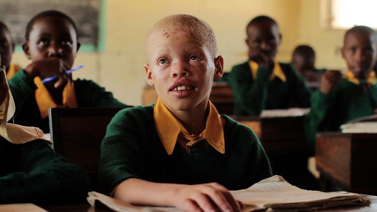 Forfulgt. Shida fra Tanzania er fjernet fra sit hjem og sat på kostskole for at beskytte ham mod dem, der vil myrde ham, fordi han er albino. Camilla Magid har fulgt drengen på kostskolen  i filmen 'Sort hvid dreng'. 