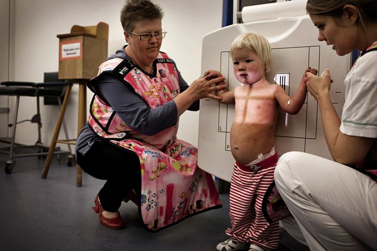 Rose. Politikens fotograf Martin Lehmann har fotograferet pigen Rose og hendes forældre, fra hun blev født med en hjertefejl og måtte gennem stå flere komplicerede operationer, der på tragisk vis resulterede i en varig hjerneskade hos barnet. 