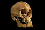 kranium. Angiveligt er dette kraniet efter den engelske konge Richard III. 