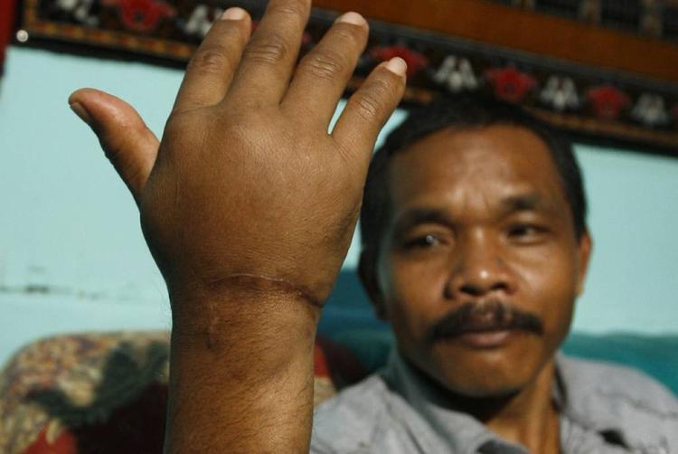 Uheldig. Parkbetjent Ahmad Main fra Komodo National Park blev forleden angrebet af en komodovaran. Og det er ikke første gang, at det er sket for ham. Tilbage i 2009 (billedet) blev han også overfaldet af en af parkens berømte beboere. 