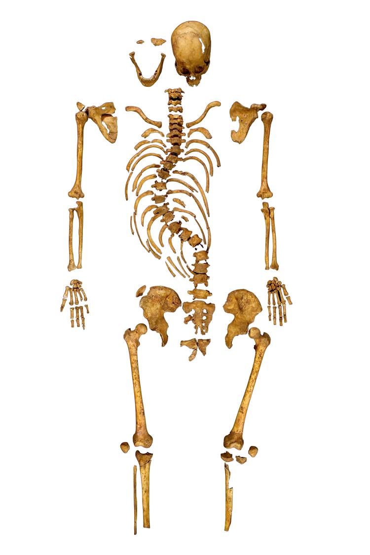 Berømt. Billedet af skelettet, der dukkede op i Leicester, går for tiden verden rundt. 