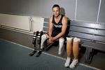 Talent. Efter flere års slagssmål fik Osvar Pistorius lov til at deltage i konkurrencer med ikke-handikappede. I sommer kom han i semifinalerne ved OL i London. I morges blev hans kæreste fundet skudt og dræbt i hans hjem. 