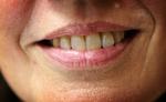 whitening? Har man meget snavsede tænder med belægninger, kan de selvfølgelig blive renere og hvidere ved, at man børster dem, men whitening tandpasta virker altså ifølge en ekspert ikke bedre end almindelig tandpasta. 