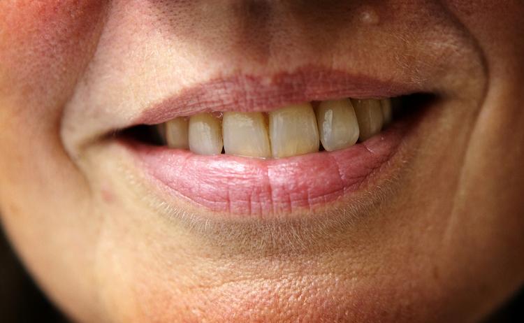 whitening? Har man meget snavsede tænder med belægninger, kan de selvfølgelig blive renere og hvidere ved, at man børster dem, men whitening tandpasta virker altså ifølge en ekspert ikke bedre end almindelig tandpasta. 