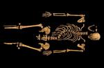 Skæv. Richard III var blandt andet kendt for sin krumme ryg, som man tydeligt kan se på skelettet. 