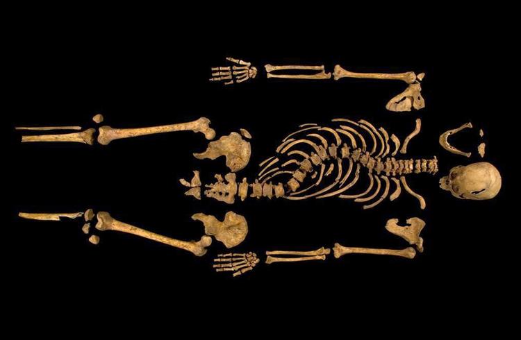 Skæv. Richard III var blandt andet kendt for sin krumme ryg, som man tydeligt kan se på skelettet. 