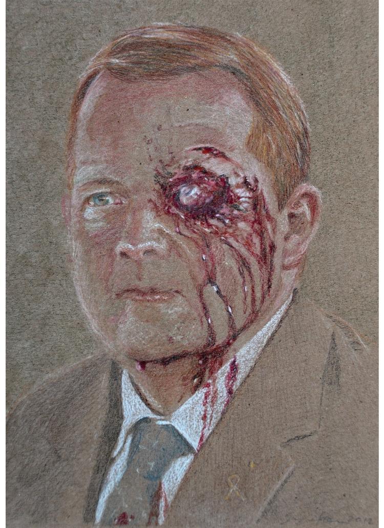 Ramt. Lars Løkke Rasmussen som såret i samlingen, der ved at lade krigens gru gå ud over de ansvarlige politikere søger at manifestere krigens konsekvenser dybere i beskueren. 