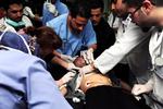 Syrien. En mand behandles på hospitalet i Damaskus efter at være bæevet såret i et morterangreb. 