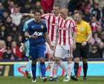 blodigt. Stokes Andy Wilkinson med blodet løbende ned af ansigtet efter at være blevet ramt af Manchester Unitteds Javier Hernandez' støvle. 