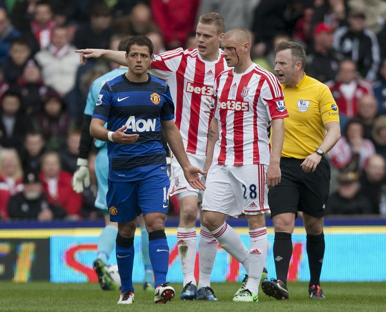 blodigt. Stokes Andy Wilkinson med blodet løbende ned af ansigtet efter at være blevet ramt af Manchester Unitteds Javier Hernandez' støvle. 