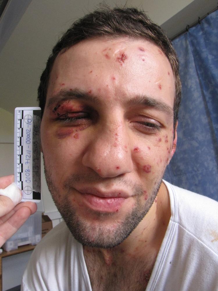 Dømt. Den terrordømte mand, der i 2011 fik 12 års fængsel for terrorplaner mod Jyllands-Posten er udleveret til Belgien. 