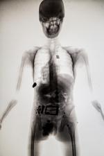 Præsentation af bodyscanner i lufthavnen
