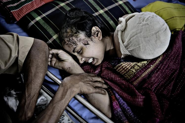 Såret. Shapla, der er blevet opereret i hovedet, har fået ambuteret en arm og brækket benet. Det er hendes far Mohsin Ali, der holder hende i hånden. 