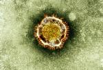 Sars. I 2002 og 2003 skabte et udbrud af Sars angst i Asien. Siden sidste år har en virus, der kan føre til Sars, floreret i Mellemøsten og Europa. 