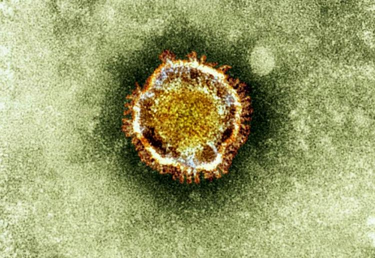 Virus. Læger og sygeplejersker skal være ekstra opmmærksomme, hvis de får patienter ind, som er kommet hjem fra den arabiske halvø. Men det betyder ikke, at man skal undgå rejser til områderne. 