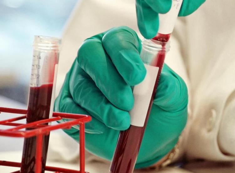 Skat. Ifølge DR 21 Søndag har Novo Nordisk kanaliseret penge fra patenter til skattely i Schweiz. 