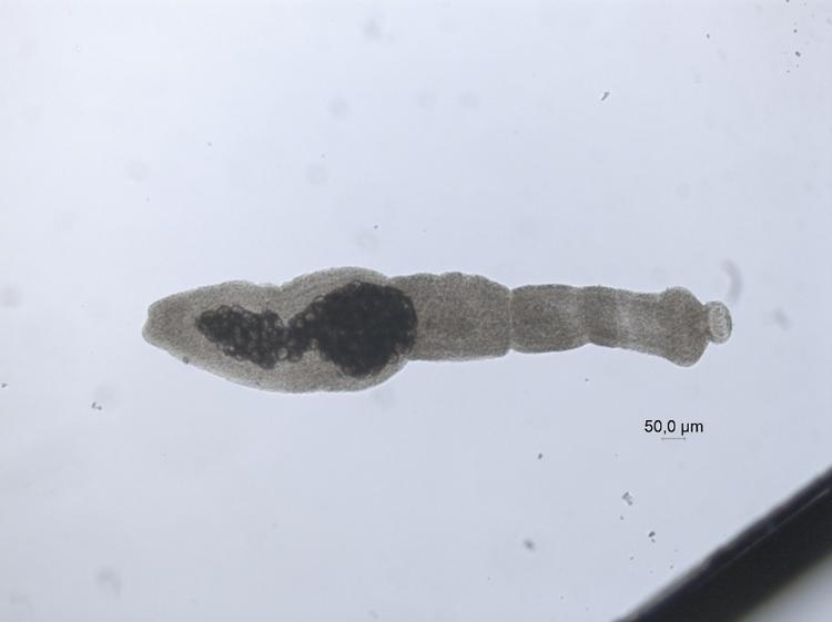 Risiko. Dværgbændelorm - Echinococcus multilocularis - kan smitte til mennesker, hvor de etablerer sig i leveren og medfører kræftlignende forandringer, som er vanskelig at behandle. 