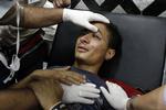 Behandling. En af de mange sårede får behandling efter sammenstødene mellem militæret og Morsi-tilhængere. 