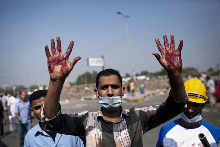 BLODIGT. En tilhænger af den afsatte præsident Mohamed Morsi har det synlige besvis på de blodige demonstrationer på sine hænder. 