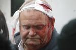 såret. En demonstrant, der ønsker at bevare forholdet til Storbritannien,  venter på at få behandling, efter at være blevet såret i de voldsomme sammenstød. 