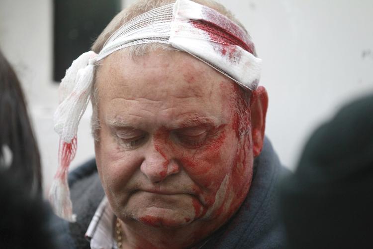 såret. En demonstrant, der ønsker at bevare forholdet til Storbritannien,  venter på at få behandling, efter at være blevet såret i de voldsomme sammenstød. 