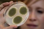Gener. Epigenetik styrer om cellens DNA kommer til udtryk. 