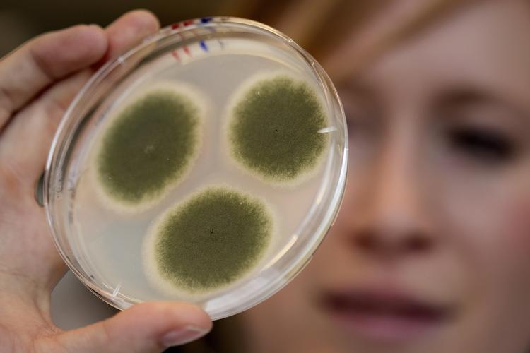 Gener. Epigenetik styrer om cellens DNA kommer til udtryk. 