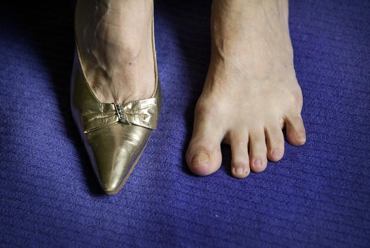 småt. Kvinder har generelt gået i for små sko. Små fødder anses for at være mere feminine end store, og det er bestemt ikke sundt for foden, hvis skoene ikke passer, siger en anatomiprofessor. 