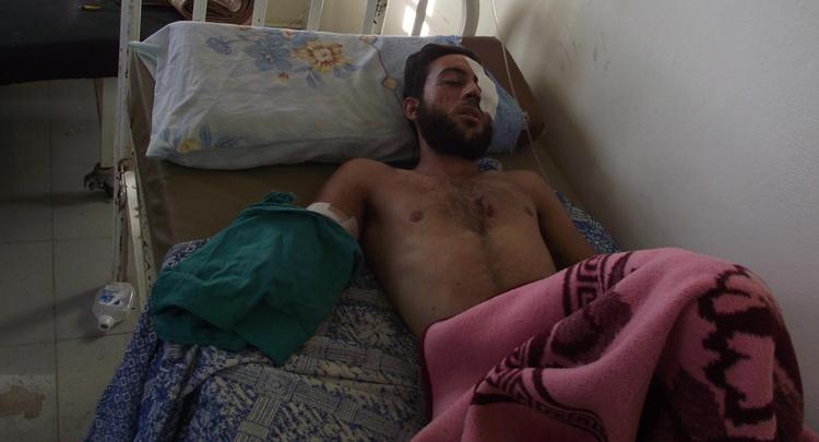 Offer. En såret syrer på et lille hospital i det nordlige Syrien måtte blandt andet have den ene arm amputeret efter et natangreb på de områder, der var kontrolleret af oprørerne. Billedet er cirka et år gammelt og taget af Brian Esbensen selv på en reportagetur i området. 