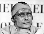 Hårdkogt. Niki Lauda afbrød en pressekonference efter ulykken, da en journalist gentagne gange spurgte, om Laudas kone ville forlade ham nu, hvor hans ansigt var ødelagt. Bagefter truede Niki Lauda journalisten med et slag i nosserne, hvis han gentog spørgsmålet. 