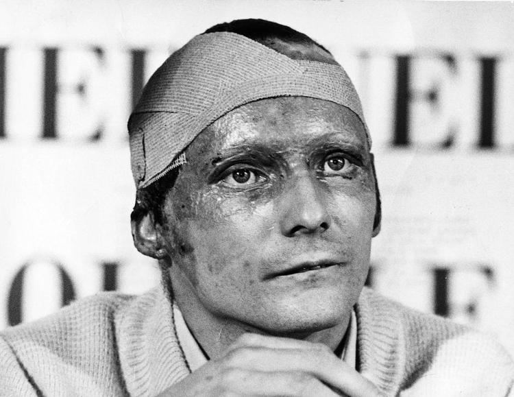 Hårdkogt. Niki Lauda afbrød en pressekonference efter ulykken, da en journalist gentagne gange spurgte, om Laudas kone ville forlade ham nu, hvor hans ansigt var ødelagt. Bagefter truede Niki Lauda journalisten med et slag i nosserne, hvis han gentog spørgsmålet. 