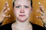 Overfølsom. Lidt mascara er alt hvad Elisabeth Svendsen bruger, efter at hun er blevet allergisk overfor stoffet MI, methylisothiazolinone. De cremer og sæber, hun bruger, skal være allergimærkede og fra mærker, som hun kender. Foto: Ditte Valente 