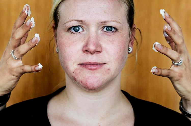 Overfølsom. Lidt mascara er alt hvad Elisabeth Svendsen bruger, efter at hun er blevet allergisk overfor stoffet MI, methylisothiazolinone. De cremer og sæber, hun bruger, skal være allergimærkede og fra mærker, som hun kender. Foto: Ditte Valente 