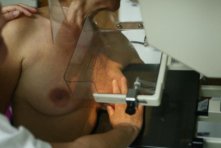 FOrebyggende. Alle danske kvinder mellem 50 og 69 år skal hvert andet år screenes for brystkræft med en såkaldt mammografi, og Danske Regioner skal nu se på, om alle indkaldelser er kommet af sted i modsætning til screeningen for livmoderhalskræft. 