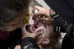 Polio. Den smitsomem sygdom er på spil i borggerkrigshærgede Syrien. 