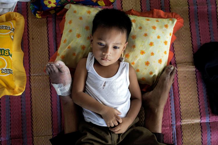Hvile. Brandon Patron på 3 år har feber og ligger mellem sin mors ben. Hun er selv kommet til skade med foden, da de flygtede fra Leyte. 