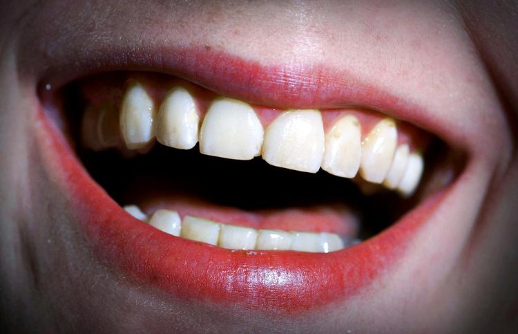 dyrere. Tandlægebesøget er blevet dyrere, og det er med til at forhindre en egentlig deflation med generelt faldende forbrugerpriser, som måske kan lyde besnærende, men som ikke er det. Ihvert fald ikke ifølge økonomerne. 