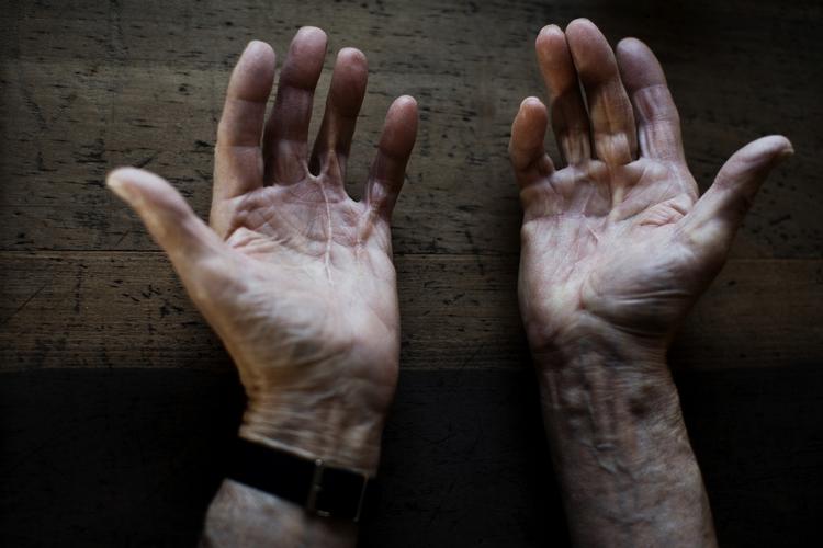 DEMENS. Det er første gang, G8-ministre mødes for at finde frem til et fælles fodslag mod den uhelbredelige sygdom. (Arkivfoto) 