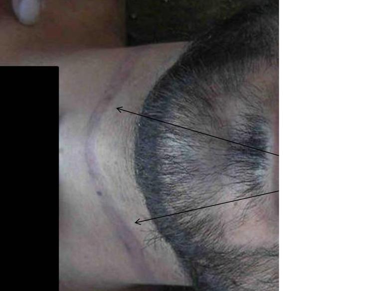 Ofre. Rapporten viser en lang række eksempler på tortur i Syrien. 