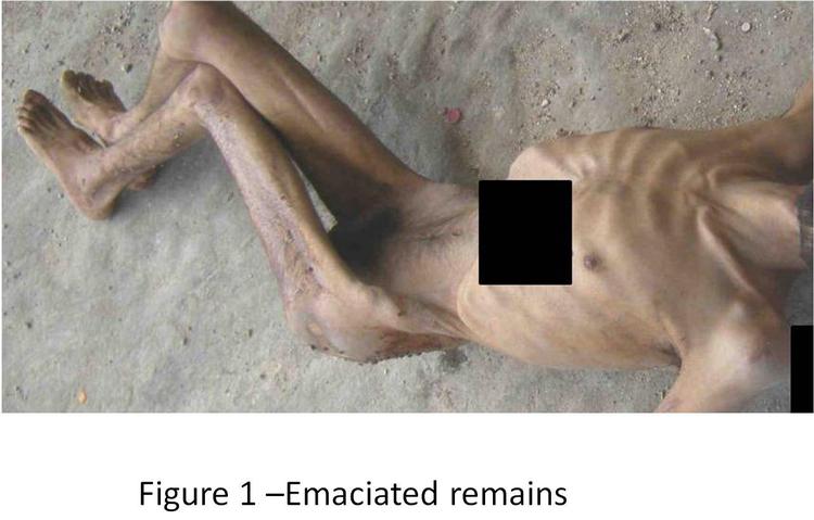 Skræmmebilleder. Rapporten viser en lang række eksempler på fanger, der er blevet udsultet og tortureret. 