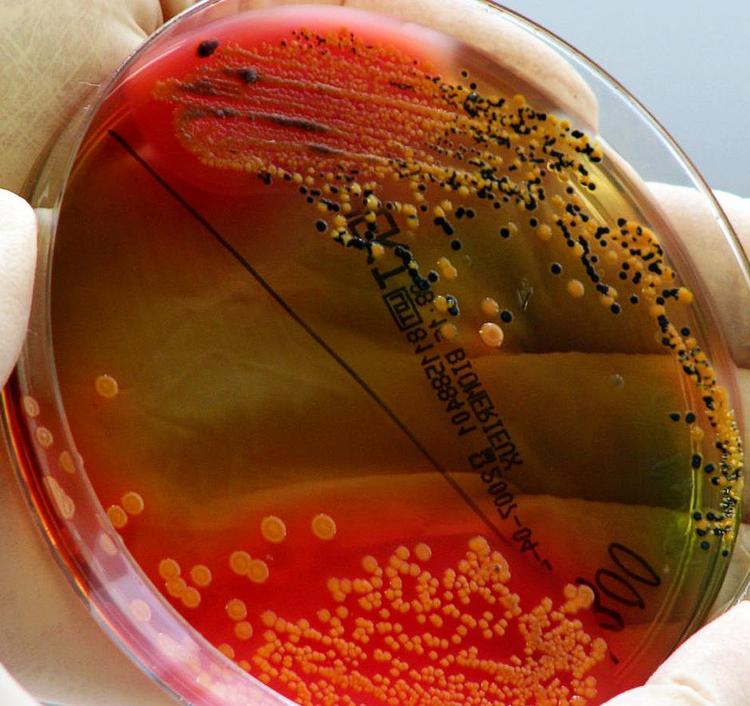 Naturvidenskab. Diarré og væsketab eller blodsygdom og bylder? Det er faktisk muligt at vælge, forklarer to overlæger og professorer. Foto: Elise Amendola, AP 