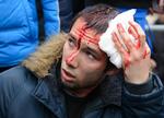 SAMMENSTØD. Her er det en af de regeringstro, der er såret, efter pro-russiske demonstranter har skabt uro i Kharkiv. 