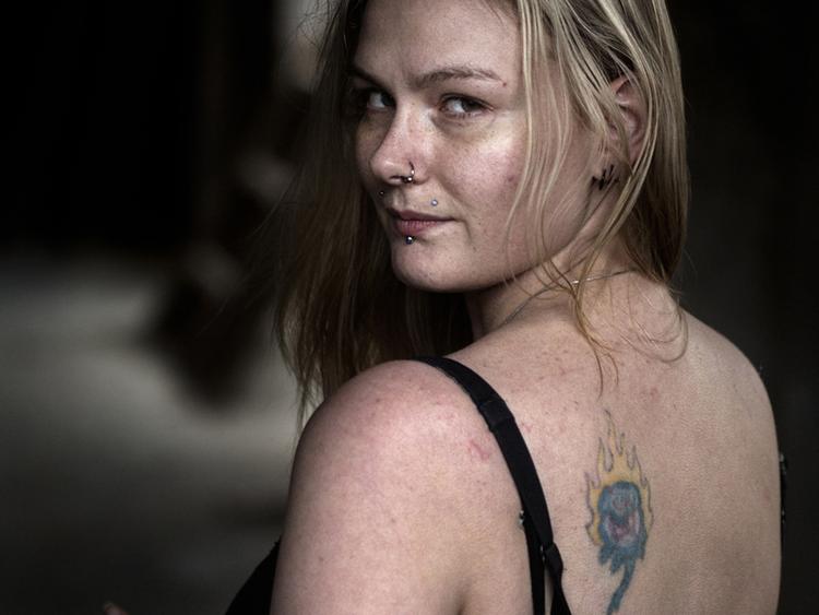 Væk. Camilla Jensen med den tatovering, som hun fik lavet i køkkenet hos en veninde. Efter to år fik hun pludselig en kraftig allergisk reaktion, og bruger nu 15.000 kroner på at få tatoveringen fjernet. 