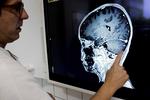 Hjernesvulst. Amalie Ravn Østergaard's far har en tumor i hjernen, der aldrig forsvinder. 