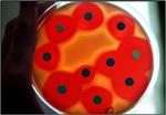 Antobiotika. Stafylokokker undergsøges for antibiotika resistens. Det sorte er en tablet med antibiotika, det røde er hæmningszonen og det orange er bakterievæksten. 