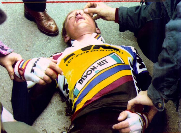 Styrt. Cykelrytteren Jesper Skibby pådrog sig et dobbelt kraniebrud efter et styrt i løbet Tirreno Adriatico i marts 1993. Fire måneder senere vandt han en etape i Tour de France. 