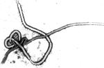 EBOLA VIRUS22 -