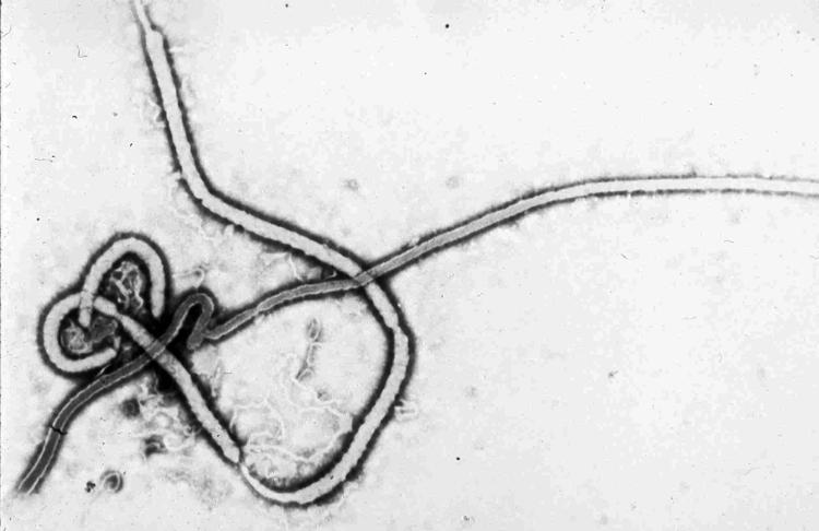 Ebola. Sådan ser ebola-virussen ud. 